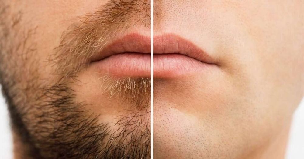 Cuidado y perfilado de barba, antes y después